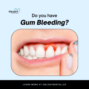 bleeding-gums-gum-enlight dental