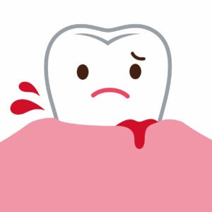 gums bleeding