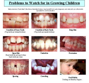 children-orthodontics
