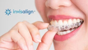 invisalign-enlightdental-kotakinabalu