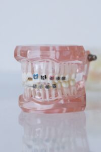 braces_enlightdental