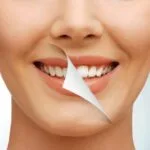 Ultimate Guide to Post-Operative Care After Professional Teeth Whitening