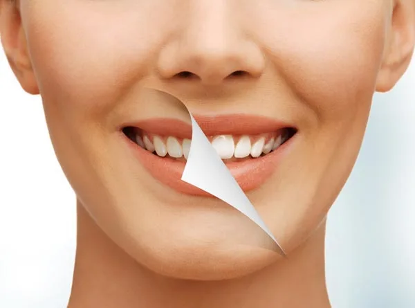 teeth_whitening_kotakinabalu