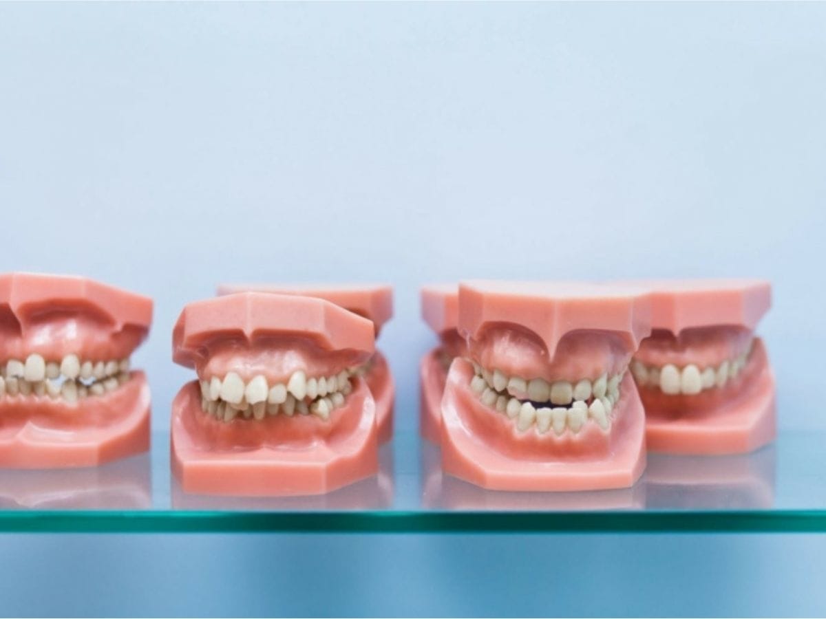 Overbites, underbites, or crossbites