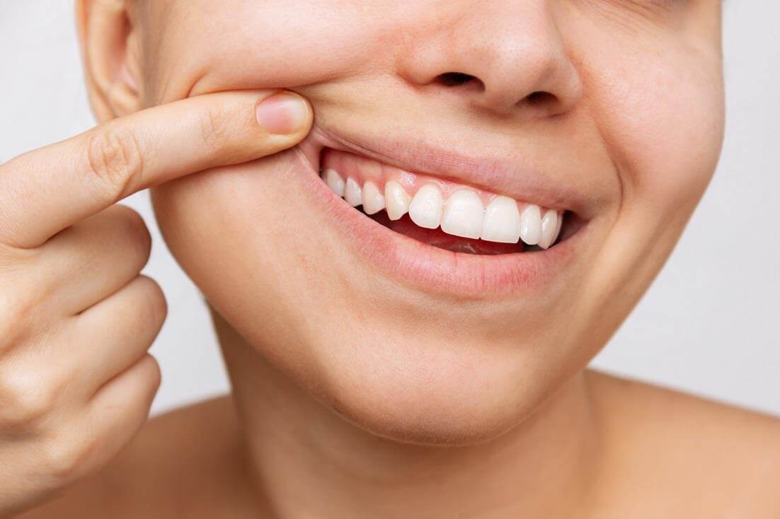 Healthy gums