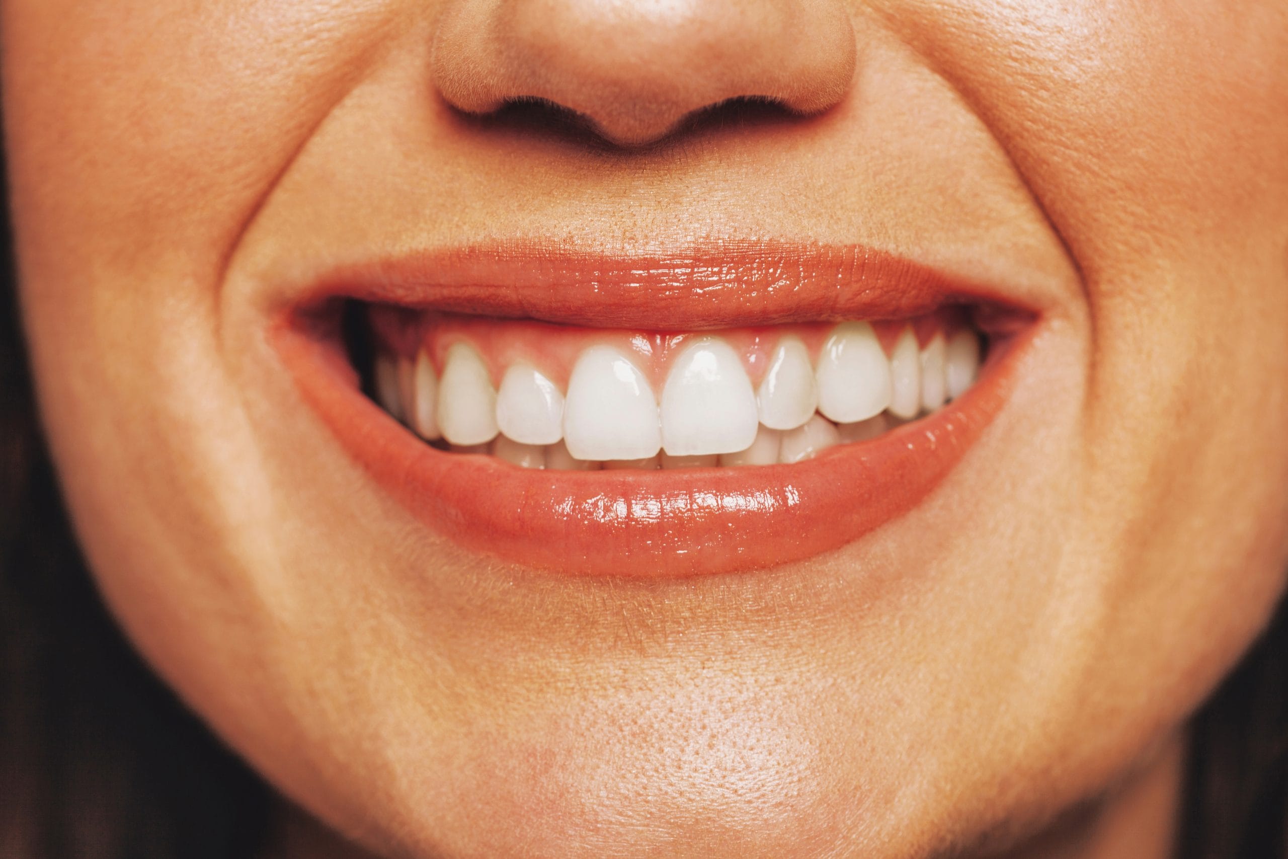 Dental Implants 1 Healthy gums