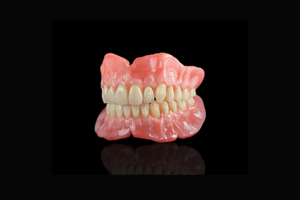 Conventional dentures