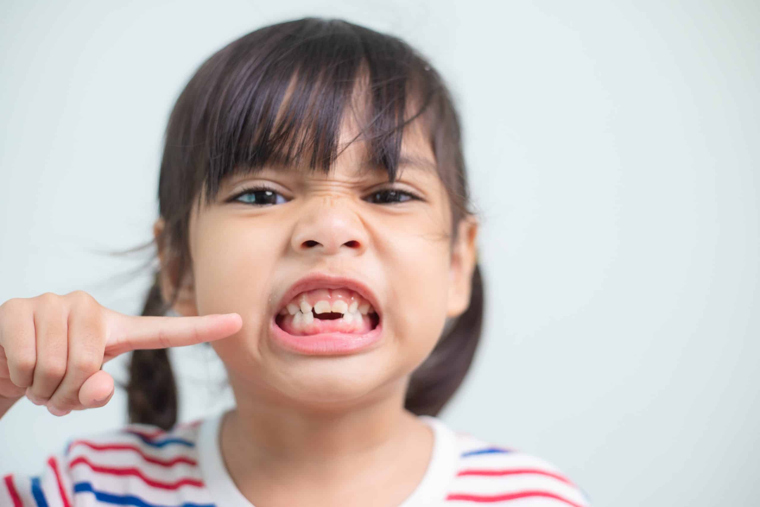 Irregular tooth growth
