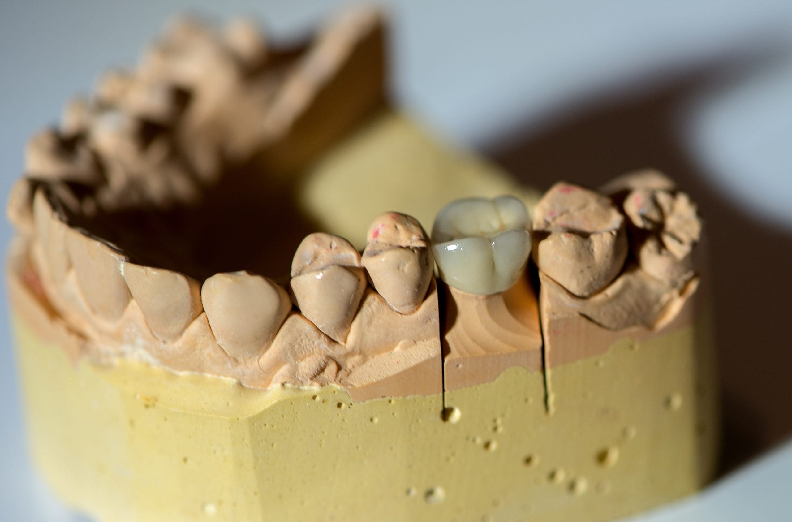 Dental crown