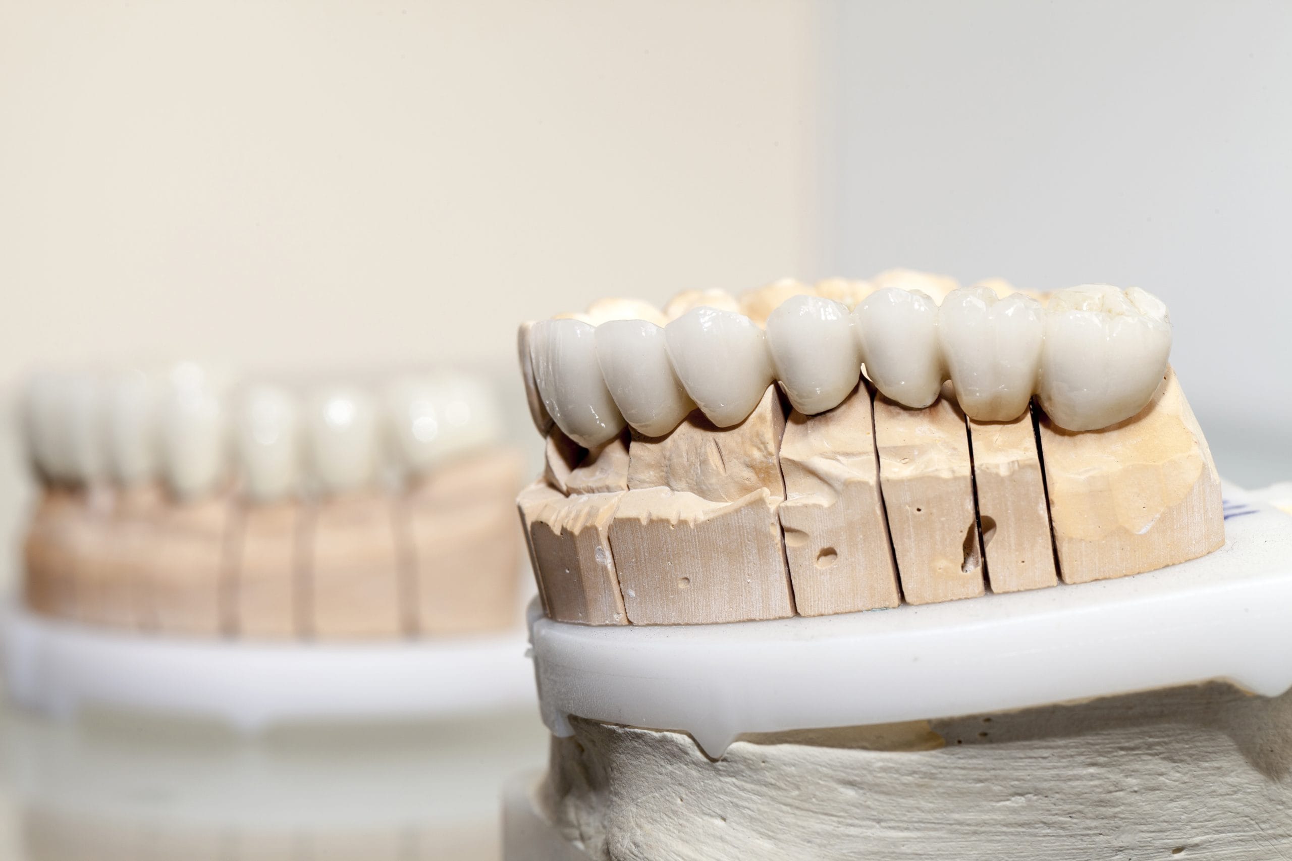 Zirconium porcelain tooth plate in dentist store 2026 03 24 10 13 22 utc scaled