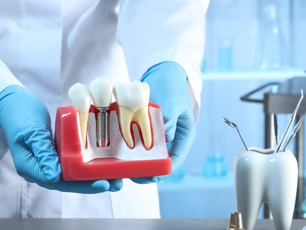 Home - Enlight Dental 15 Dental implants
