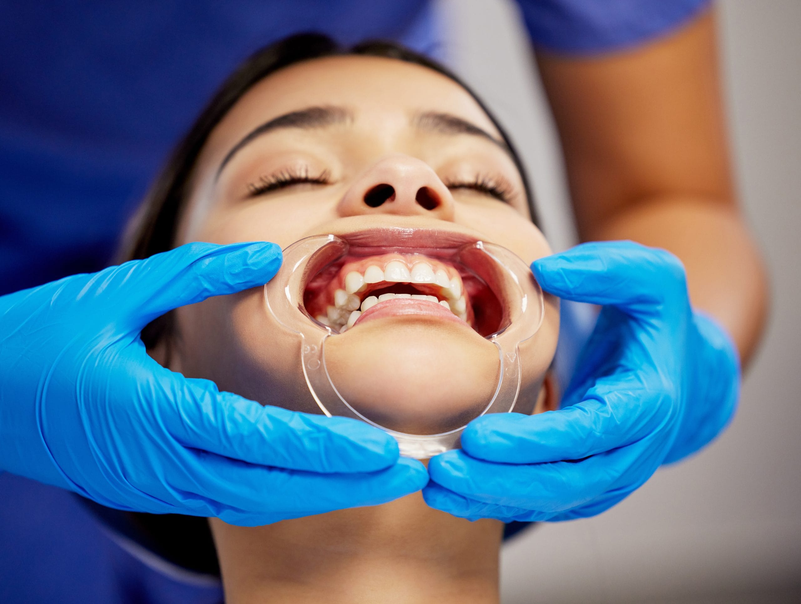 Full mouth rehabilitation