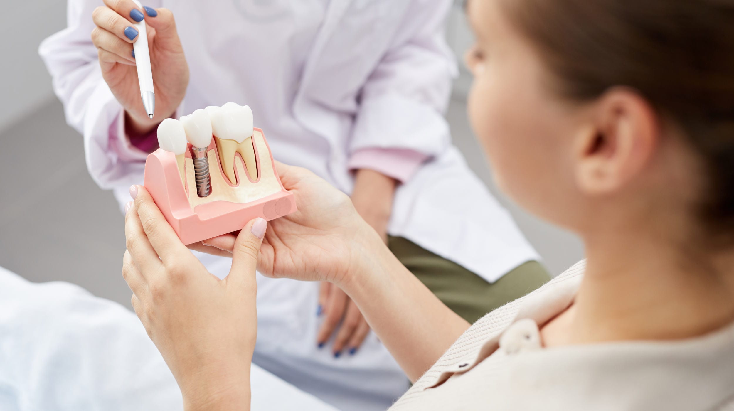 Dental implant