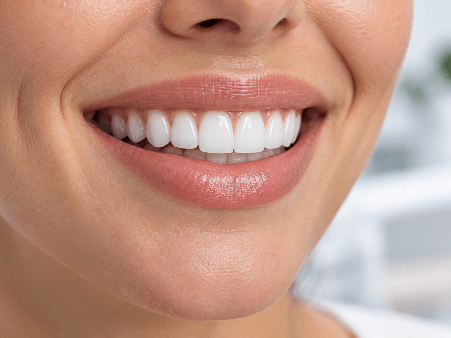 dental veneers