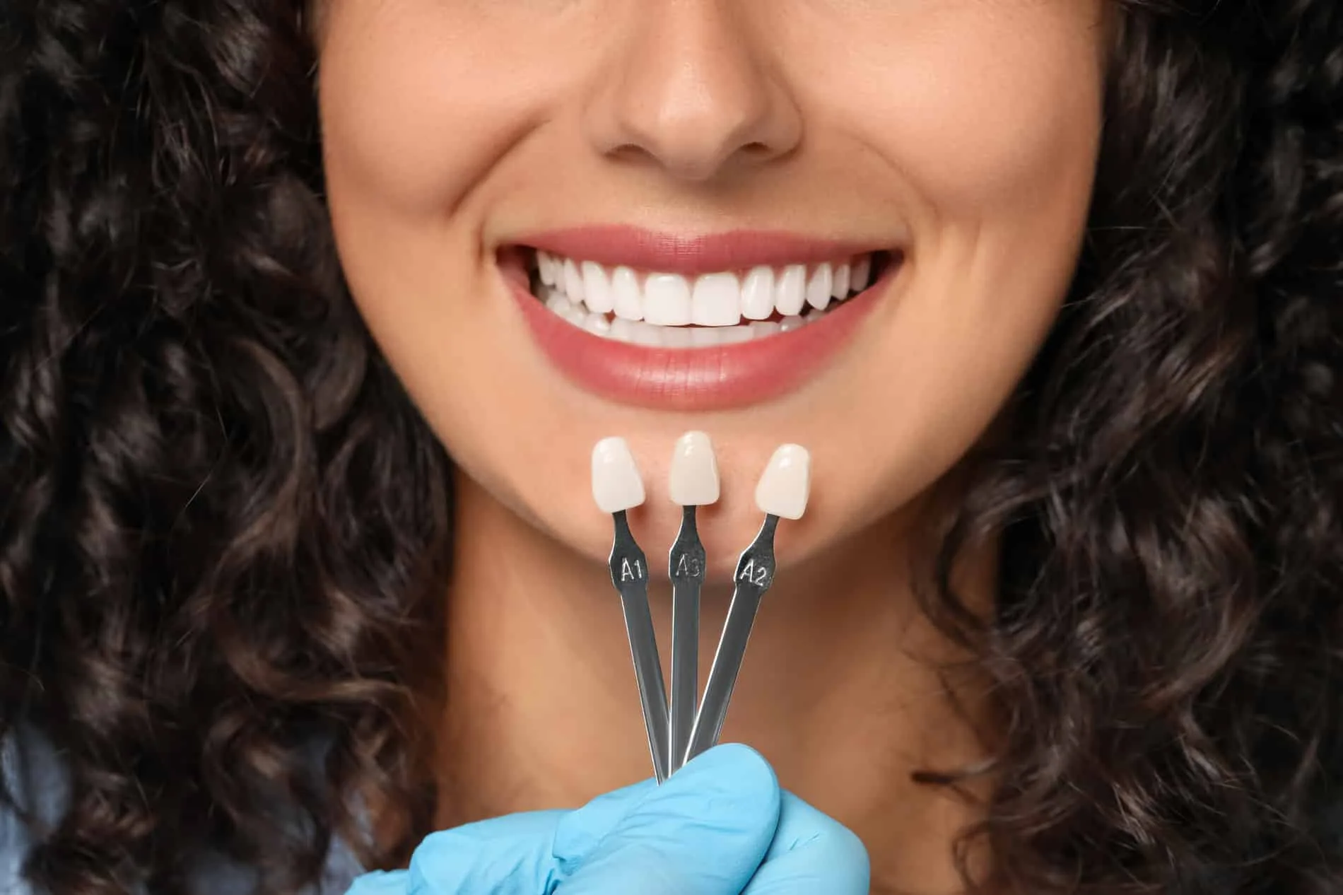 Thinking Of Getting Veneers? Here'S How They Work And Who They Suit 2 Veneers
