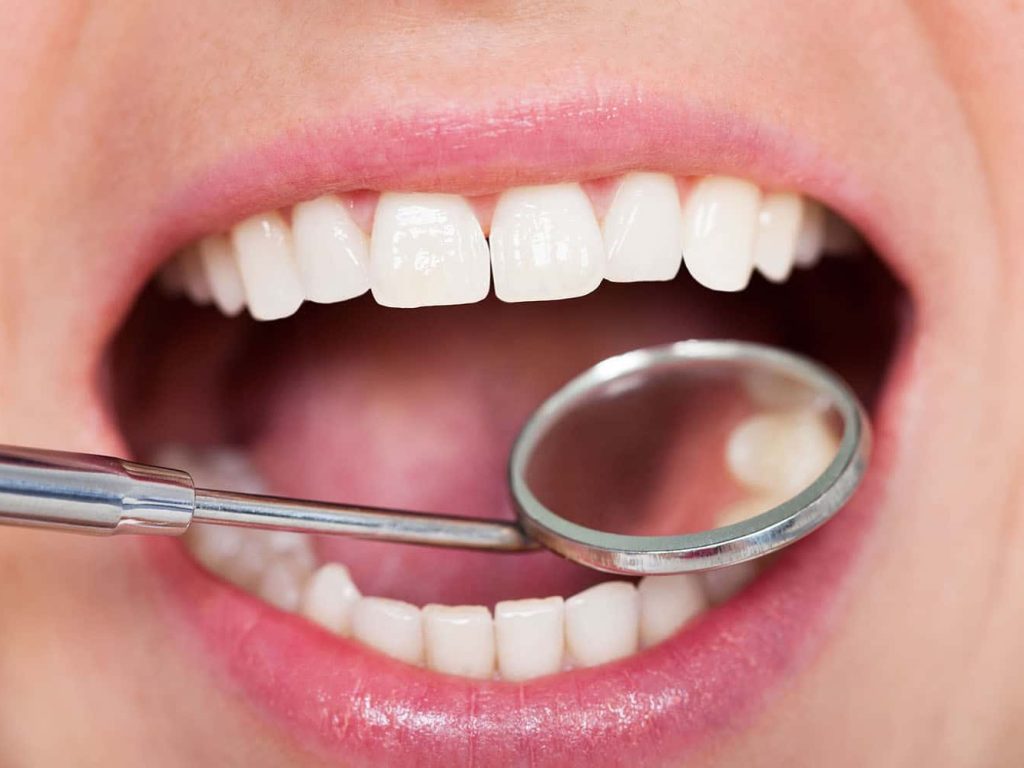 Dental Inspection Dentist checked for issues