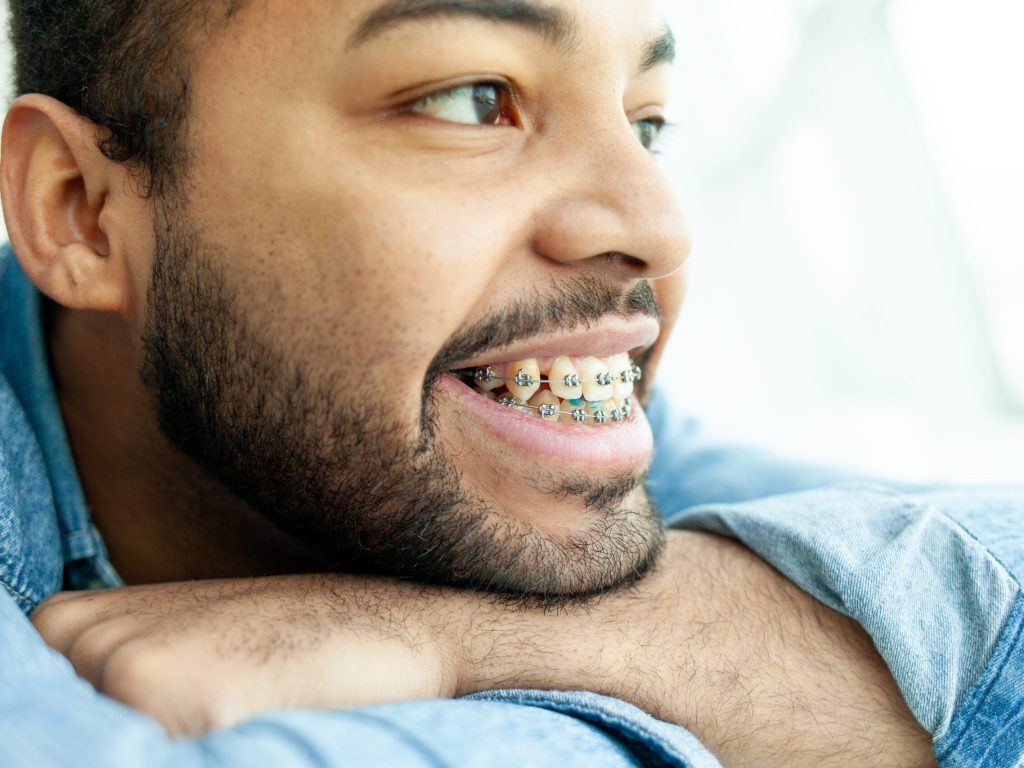 With braces adults who want a discreet option