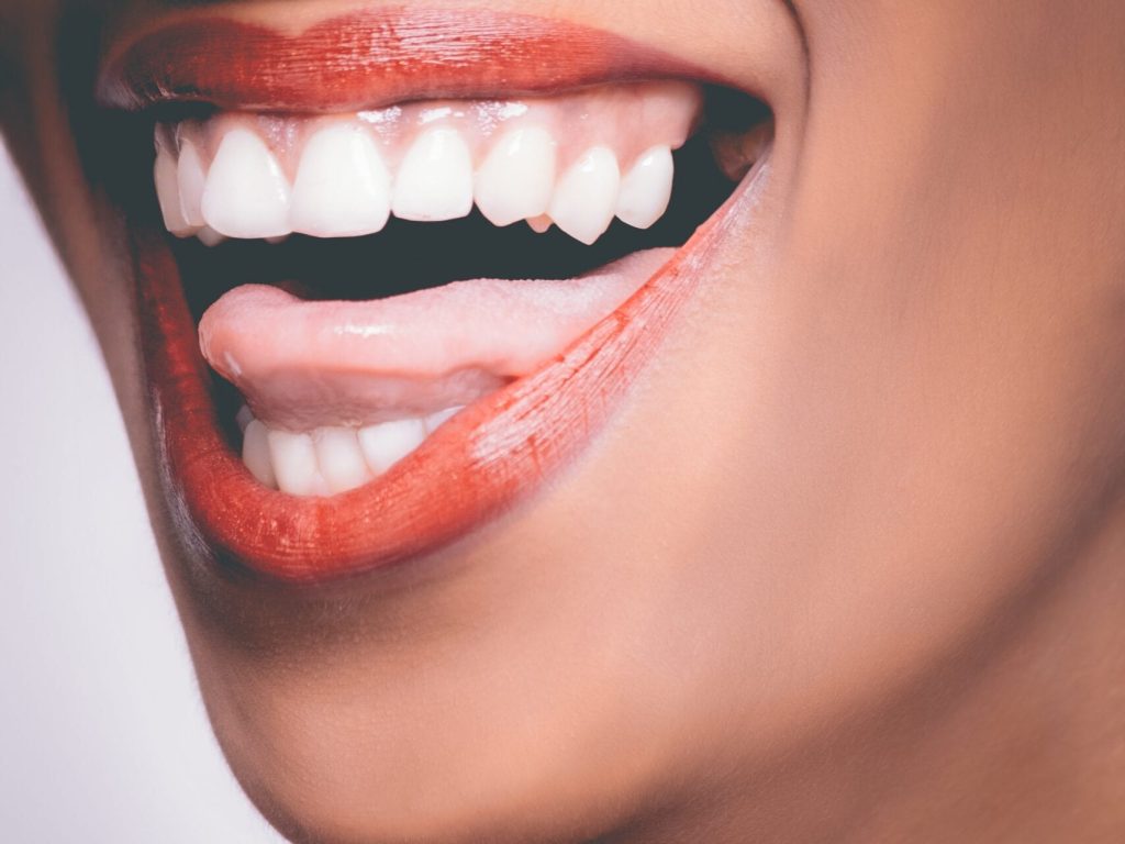 White Teeth White teeth
